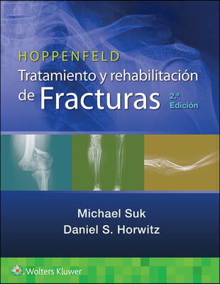 Hoppenfeld. Tratamiento Y Rehabilitacion de Fracturas