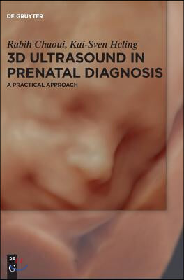 3D Ultrasound in Prenatal Diagnosis: A Practical Approach