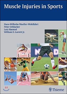 Muscle Injuries in Sports