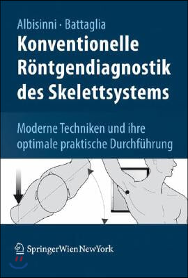 Konventionelle Rontgendiagnostik Des Skelettsystems: 900 Moderne Techniken Und Ihre Optimale Praktische Durchfuhrung