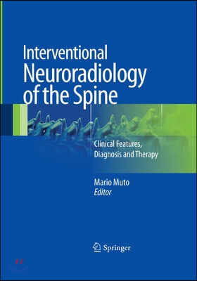 Interventional Neuroradiology of the Spine: Clinical Features, Diagnosis and Therapy