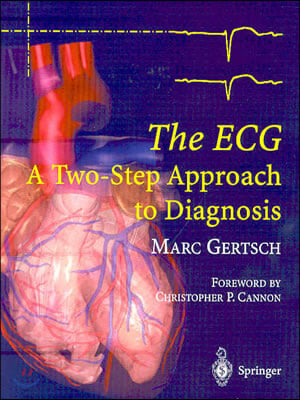 The ECG: A Two-Step Approach to Diagnosis