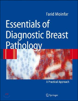 Essentials of Diagnostic Breast Pathology