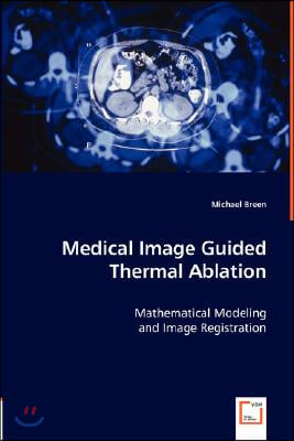 Medical Image Guided Thermal Ablation