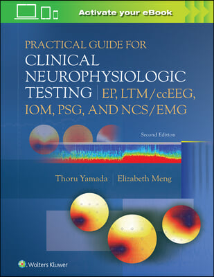 Practical Guide for Clinical Neurophysiologic Testing: Ep, Ltm/Cceeg, Iom, Psg, and Ncs/Emg