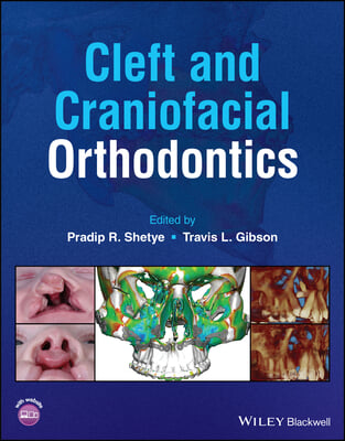 The Cleft and Craniofacial Orthodontics