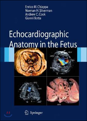 Echocardiographic Anatomy in the Fetus