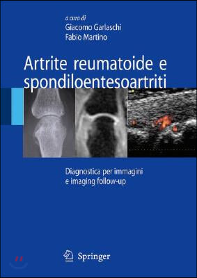 Artrite Reumatoide E Spondiloentesoartriti: Diagnostica Per Immagini Ed Imaging Follow-Up