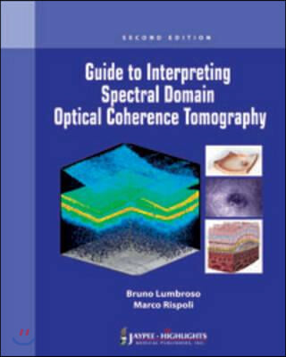 Guide to Interpreting Spectral Domain Optical Coherence Tomography