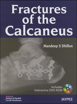 Fractures of the Calcaneus [With DVD ROM]