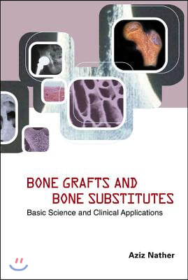 Bone Grafts and Bone Substitutes: Basic Science and Clinical Applications