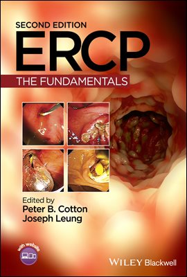 ERCP