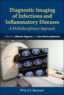 Diagnostic Imaging of Infections and Inflammatory Diseases