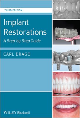 Implant Restorations