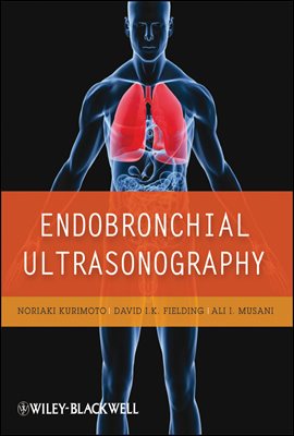 Endobronchial Ultrasonography