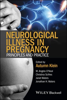 Neurological Illness in Pregnancy