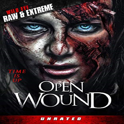 Open Wound (오픈 운드)(지역코드1)(한글무자막)(DVD)