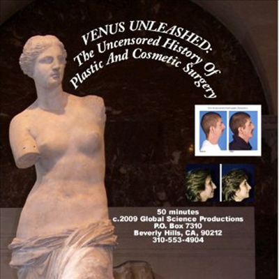 Venus Unleashed: The Uncensored History Of Plastic And Cosmetic Surgery (비너스 언리쉬드)(지역코드1)(한글무자막)(DVD)