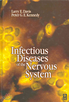 Infectious Diseases of the Nervous System