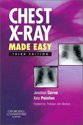 Chest X-ray Made Easy, 3/E