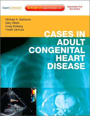 Cases in Adult Congenital Heart Disease (With Access Code)