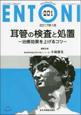 耳管の檢査と處置－治療效果を上げるコツ－