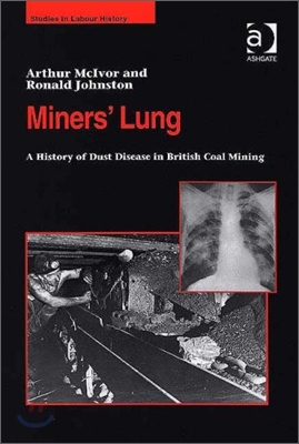 Miners&#39; Lung