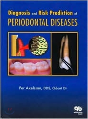 Diagnosis and Risk Prediction of Periodontal Diseases