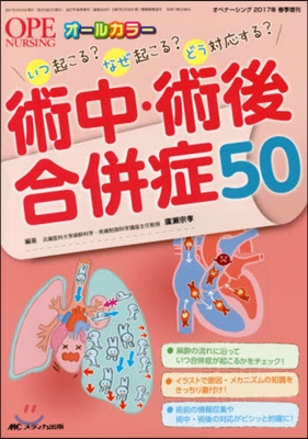 術中.術後合倂症50