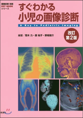 すぐわかる小兒の畵像診斷 改訂第2版