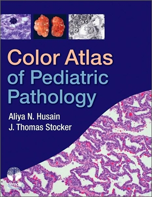 Color Atlas of Pediatric Pathology