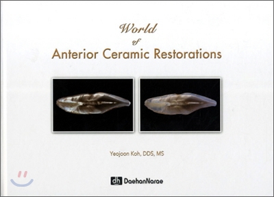 World of Anterior Ceramic Restorations