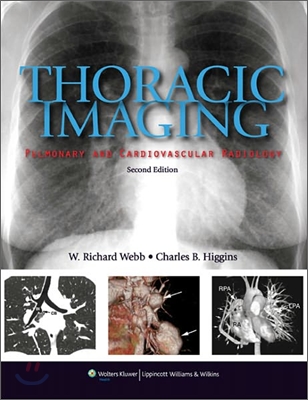 Thoracic Imaging