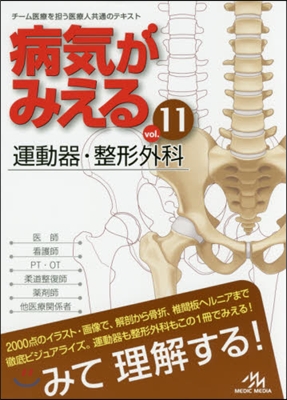 病氣がみえる vol.11 運動器.整形外科