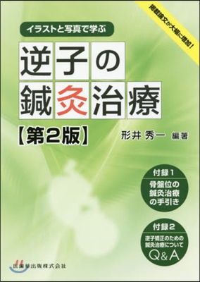 イラストと寫眞で學ぶ逆子の鍼灸治療 2版