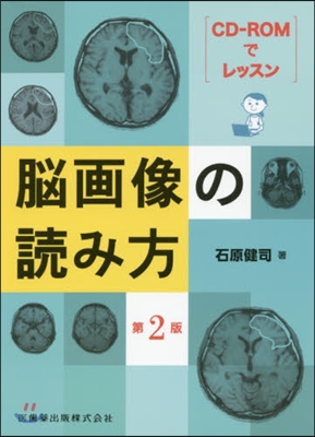 腦畵像の讀み方 第2版