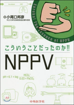 こういうことだったのか!!NPPV