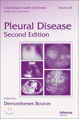 Pleural Disease