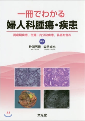 一冊でわかる婦人科腫瘍.疾患 周産期疾患