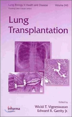 Lung Transplantation