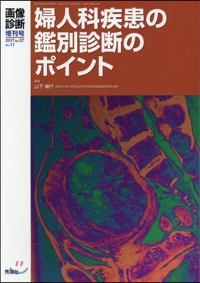 婦人科疾患の鑑別診斷のポイント