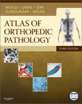 Atlas of Orthopedic Pathology : with CD-ROM (Hardcover, 3 Revised edition)