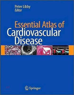 Essential Atlas of Cardiovascular Disease [With CDROM]