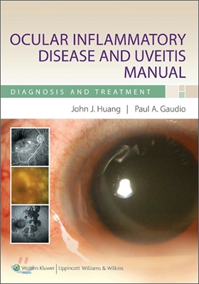 Ocular Inflammatory Disease and Uveitis Manual