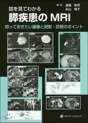 圖を見てわかる膵疾患のMRI 知っておき