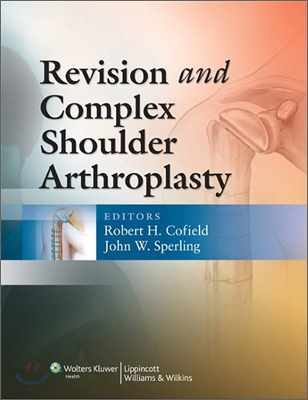 Revision and Complex Shoulder Arthroplasty