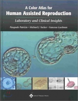 A Color Atlas for Human Assisted Reproduction: Laboratory and Clinical Insights