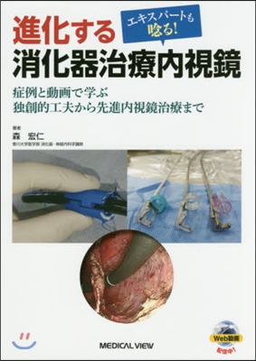 進化する消化器治療內視鏡 症例と動畵で學