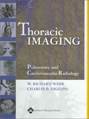 Thoracic Imaging