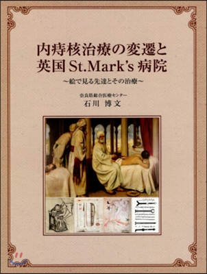 內痔核治療の變遷と英國 St.Mark’